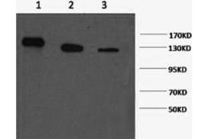 Western Blotting (WB) image for anti-Poly (ADP-Ribose) Polymerase 1 (PARP1) antibody (ABIN5958315) (PARP1 抗体)
