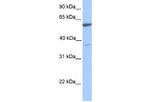 WB Suggested Anti-NAB2 Antibody Titration:  0. (NAB2 抗体  (C-Term))