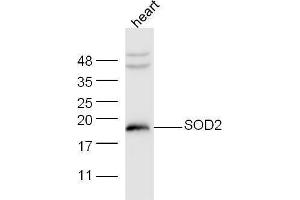 Mouase heart lysates probed with Anti-SOD2 Polyclonal Antibody at 1:5000 90min in 37˚C. (SOD2 抗体  (AA 41-78))