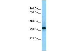 WB Suggested Anti-CD86 Antibody Titration: 1. (CD86 抗体  (C-Term))