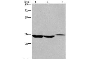 Western Blot analysis of Lovo cell,Human liver cancer tissue and Mouse kidney tissue using ING2 Polyclonal Antibody at dilution of 1:425 (ING2 抗体)