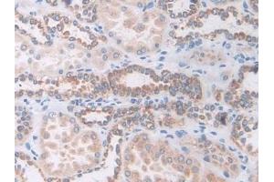 Immunohistochemistry (IHC) image for anti-Solute Carrier Family 12 (Sodium/Chloride Transporters), Member 3 (SLC12A3) (AA 867-1024) antibody (ABIN7441745)