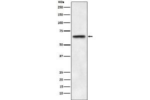 Western blot analysis of ABCE1 expression in HeLa cell lysate.