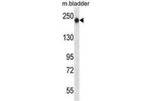 BRIP1 Antibody (N-term) western blot analysis in mouse bladder tissue lysates (35µg/lane). (BRIP1 抗体  (N-Term))