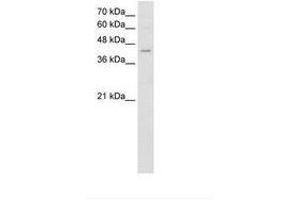 Image no. 1 for anti-Fatty Acid Desaturase 1 (FADS1) (AA 428-477) antibody (ABIN204996) (FADS1 抗体  (AA 428-477))