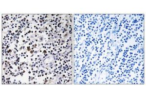 Immunohistochemistry analysis of paraffin-embedded human lymph node tissue using CD302 antibody. (DCL1 抗体  (Internal Region))