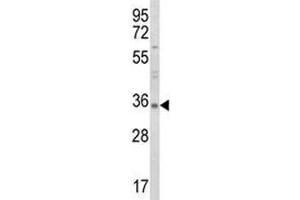Western Blotting (WB) image for anti-Tumor Necrosis Factor (Ligand) Superfamily, Member 11 (TNFSF11) (AA 1-30) antibody (ABIN3029354)