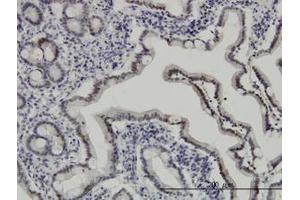 Image no. 2 for anti-Apoptosis Inhibitor 5 (API5) (AA 400-504) antibody (ABIN466131) (Apoptosis Inhibitor 5 抗体  (AA 400-504))