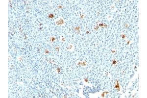 Formalin-fixed, paraffin-embedded human tonsil stained with Calprotectin Monoclonal Antibody (CPT/1028) (S100A9 抗体)