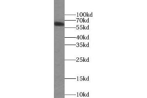 WB analysis of HepG2 cells subjected to SDS-PAGE, using PLAP antibody (1/1000 dilution). (PLAP 抗体)