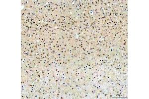IHC analysis of FTO using anti-FTO antibody (ABIN7601059). (FTO 抗体  (AA 279-505))