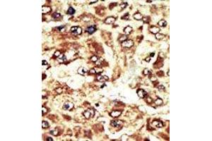 Image no. 2 for anti-WEE1 Homolog (S. Pombe) (WEE1) (C-Term) antibody (ABIN360579) (WEE1 抗体  (C-Term))