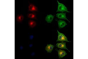 ABIN6265576 and ABIN6273176 staining HUVEC cells by IF/ICC.
