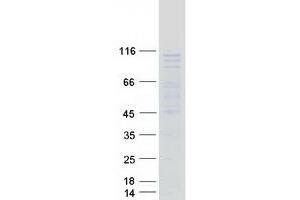 Western Blotting (WB) image for Digestive Organ Expansion Factor Homolog (DIEXF) protein (Myc-DYKDDDDK Tag) (ABIN2714001)