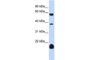 WB Suggested Anti-HTR3E Antibody Titration:  0. (HTR3E 抗体  (Middle Region))
