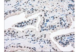 Immunohistochemical staining of paraffin-embedded Ovary tissue using anti-SSBmouse monoclonal antibody. (SSB 抗体)