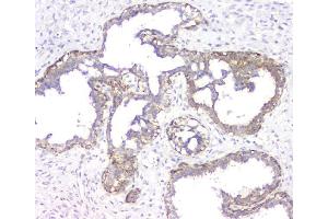 IHC analysis of RMI2 using anti-RMI2 antibody (ABIN6719656). (RMI2 抗体)