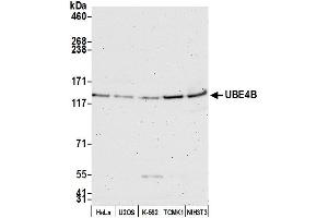 Western Blotting (WB) image for anti-Ubiquitin Conjugation Factor E4 B (UBE4B) (AA 125-175) antibody (ABIN7450865)