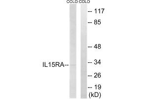 Western blot analysis of extracts from COLO cells, using IL15RA antibody. (IL15RA 抗体  (Internal Region))
