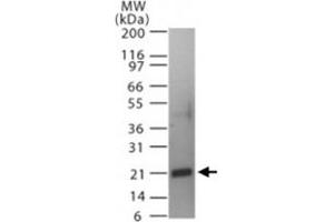 Western blot analysis of Tnfsf11 in a partial His-tagged recombinant protein. (RANKL 抗体  (AA 161-177))