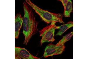 Immunofluorescence analysis of Hela cells using NEFL mouse mAb (green). (NEFL 抗体)