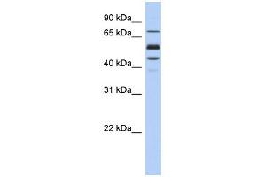 WB Suggested Anti-PROS1 Antibody Titration: 0. (PROS1 抗体  (Middle Region))