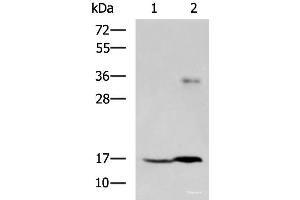 Western blot analysis of A172 cell and Human cerebrum tissue lysates using TMEM42 Polyclonal Antibody at dilution of 1:800 (TMEM42 抗体)