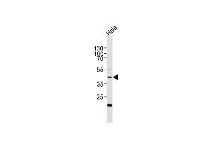 Anti-E2F1 Antibody at 1:2000 dilution + Hela whole cell lysates Lysates/proteins at 20 μg per lane.