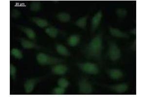 Immunostaining analysis in HeLa cells. (SOX4 抗体)