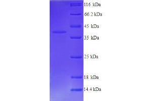 SDS-PAGE (SDS) image for Wingless-Type MMTV Integration Site Family, Member 3 (WNT3) (AA 22-355) protein (His tag) (ABIN5713948)