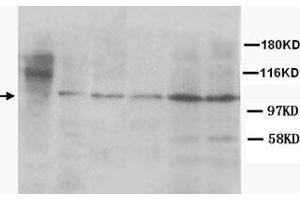 Western Blot analysis of CUL4B expression from cell and tissue extracts with CUL4B polyclonal antibody . (Cullin 4B 抗体)