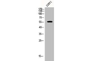 Western Blot analysis of 22RV1 cells using CYP2A7 Polyclonal Antibody (CYP2A7 抗体  (C-Term))