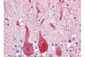 Human Brain, Cerebellum (formalin-fixed, paraffin-embedded) stained with ALDOCfollowed by biotinylated goat anti-rabbit IgG secondary antibody, alkaline phosphatase-streptavidin and chromogen. (ALDOC 抗体  (C-Term))