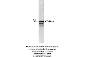 Image no. 1 for anti-Peripherin (PRPH) (full length) antibody (ABIN363318) (Peripherin 抗体  (full length))
