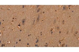 Immunohistochemistry of paraffin-embedded Human brain tissue using COL18A1 Polyclonal Antibody at dilution 1:40 (COL18A1 抗体)