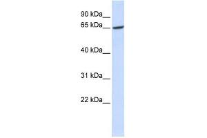 GPR177 antibody used at 1 ug/ml to detect target protein. (GPR177/WLS 抗体  (Middle Region))