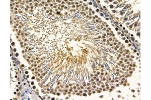 ABIN7096863 and ABIN7100929 at 1/100 staining rat testis tissue by IHC-P. (RFX2 抗体)