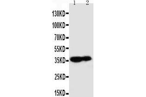 Anti-Kallikrein 9 antibody, Western blotting Lane 1: MCF-7 Cell Lysate Lane 2: A431 Cell Lysate (Kallikrein 9 抗体  (C-Term))