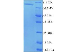 SDS-PAGE (SDS) image for N-Acetylated alpha-Linked Acidic Dipeptidase-Like 2 (NAALADL2) (AA 143-795), (Extracellular) protein (His-SUMO Tag) (ABIN5711381) (NAALADL2 Protein (AA 143-795, Extracellular) (His-SUMO Tag))