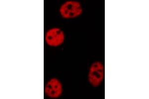 ABIN6272261 staining COLO205 by IF/ICC. (CEBPZ 抗体  (N-Term))