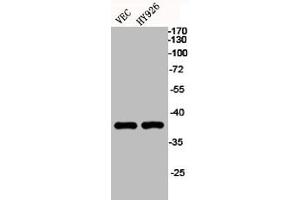 Western Blot analysis of VEC HY926 cells using EKLF/CKLF/UKLF Polyclonal Antibody (KLF1/5/7 抗体  (C-Term))