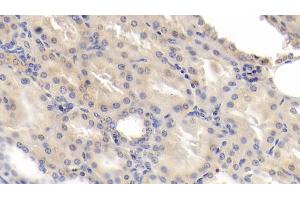 Detection of CDK2AP1 in Human Kidney Tissue using Polyclonal Antibody to Cyclin Dependent Kinase 2 Associated Protein 1 (CDK2AP1) (CDK2AP1 抗体  (AA 1-115))
