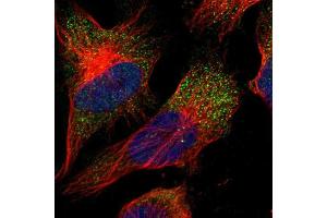 Immunofluorescent staining of human cell line U-251 MG shows localization to vesicles. (CNTF 抗体  (AA 105-198))
