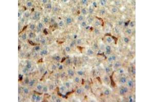 Used in DAB staining on fromalin fixed paraffin-embedded Liver tissue (Orexin A 抗体  (AA 33-124))