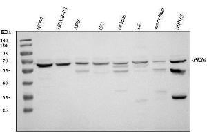 Western blot analysis of PKM2 using anti-PKM2 antibody (ABIN3043381).