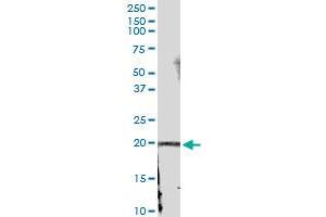 Immunoprecipitation of IFNA21 transfected lysate using anti-IFNA21 MaxPab rabbit polyclonal antibody and Protein A Magnetic Bead , and immunoblotted with IFNA21 MaxPab mouse polyclonal antibody (B01) . (IFNA21 抗体  (AA 1-189))