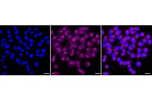 Immunocytochemical staining of HepG2 cells with DNPH1 antibody (ABIN7798082), 1:1,000). (Recombinant RCL 抗体)