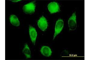 Immunofluorescence of purified MaxPab antibody to CYB5R3 on HeLa cell. (CYB5R3 抗体  (AA 1-301))