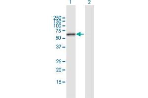 Western Blot analysis of ERO1L expression in transfected 293T cell line by ERO1L MaxPab polyclonal antibody. (ERO1L 抗体  (AA 1-468))