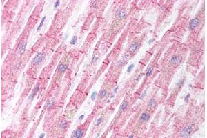 Human Heart (formalin-fixed, paraffin-embedded) stained with BCL2L11 antibody ABIN213909 at 5 ug/ml followed by biotinylated goat anti-rabbit IgG secondary antibody ABIN481713, alkaline phosphatase-streptavidin and chromogen. (BIM 抗体  (Internal Region))